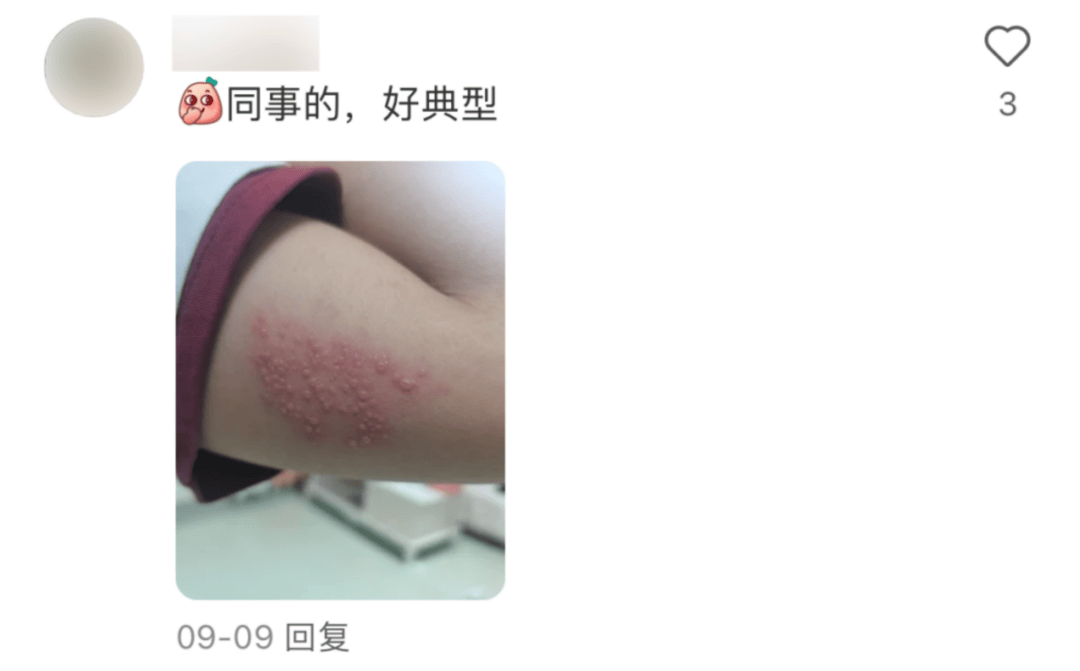 皇冠信用网会员开户_一旦感染终身携带皇冠信用网会员开户!深圳疾控提醒:这4类人要注意