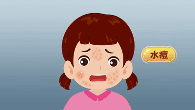 皇冠信用网会员开户_一旦感染终身携带皇冠信用网会员开户!深圳疾控提醒:这4类人要注意