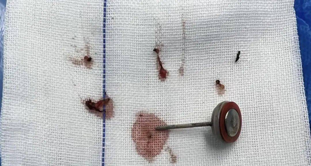 怎么注册皇冠信用網_2岁孩子一口咬下瞬间爆炸!几乎家家都有怎么注册皇冠信用網,务必警惕