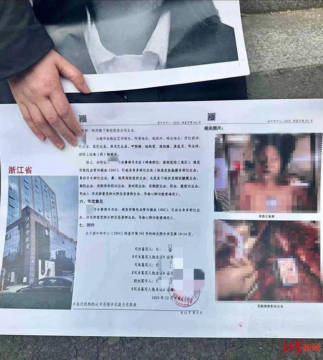 welcome皇冠注册_21岁女孩被曝做隆鼻手术后死亡welcome皇冠注册,宁波鄞州区卫健局:已介入调查