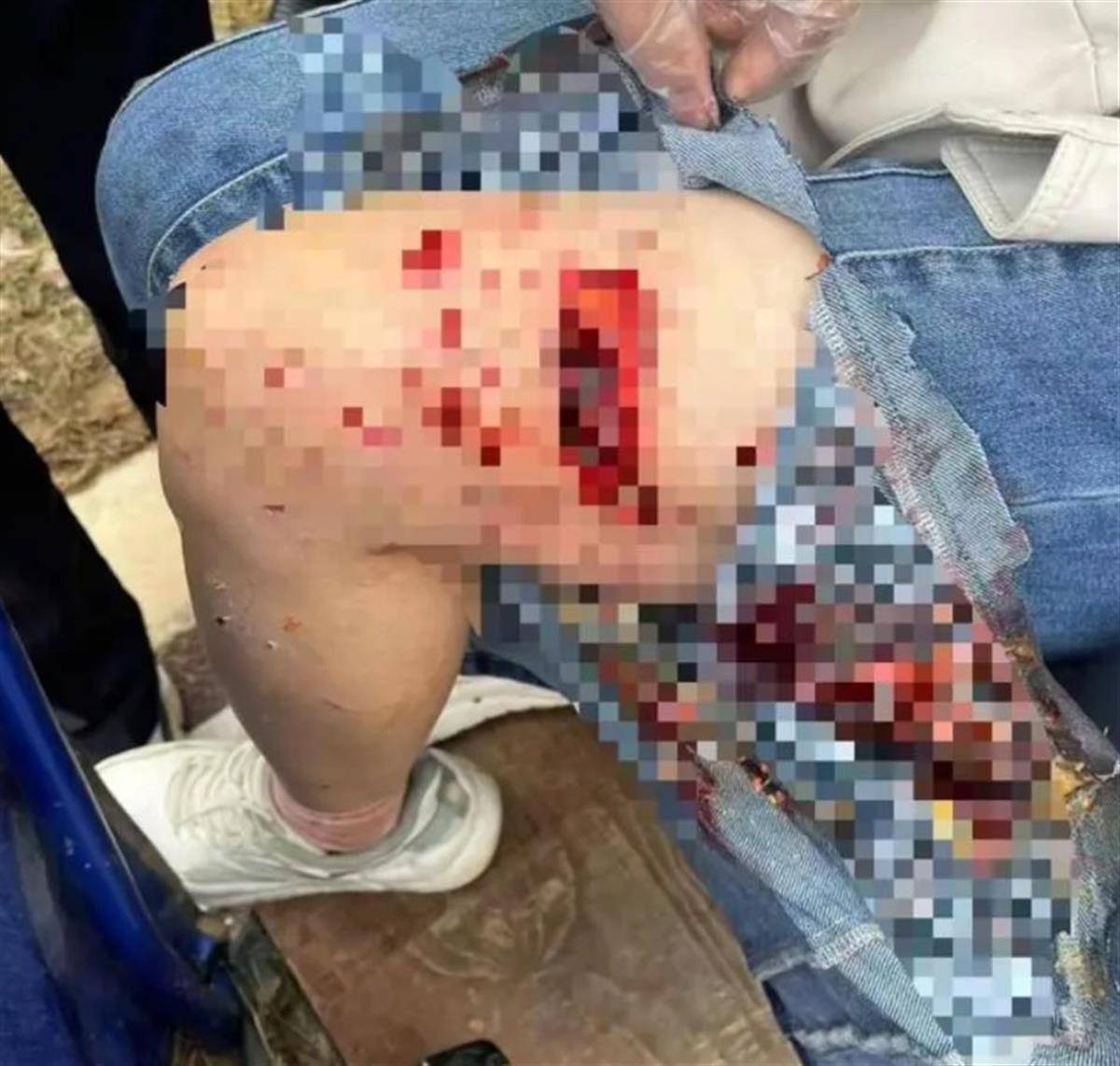 信用盘皇冠申请注册_母女散步遭4条大型犬撕咬:狗主人系当地一工程老板 已被采取强制措施