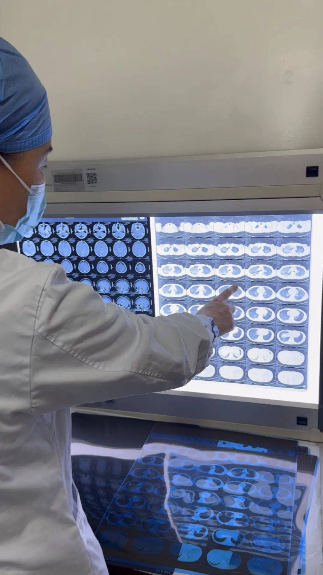 如何代理皇冠信用盘
_河南一大学生咳嗽发烧近一月如何代理皇冠信用盘
,多家诊所误当感冒治,医生:肺已全白