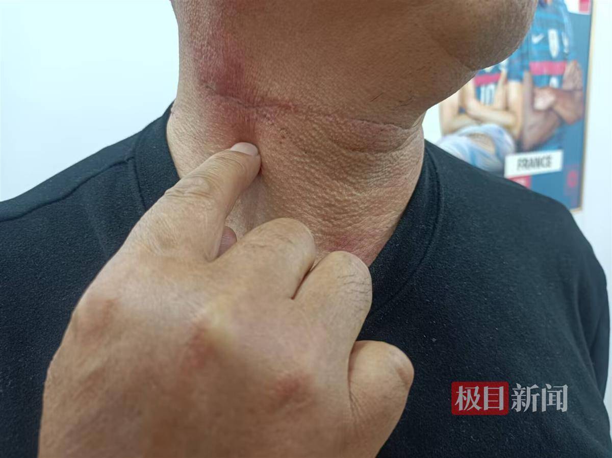 阿美尼亚超级联赛
_病房悲剧之谜：男子住院当晚捅伤同病房父子并跳楼身亡阿美尼亚超级联赛
，医院称其入院时无精神异常表现