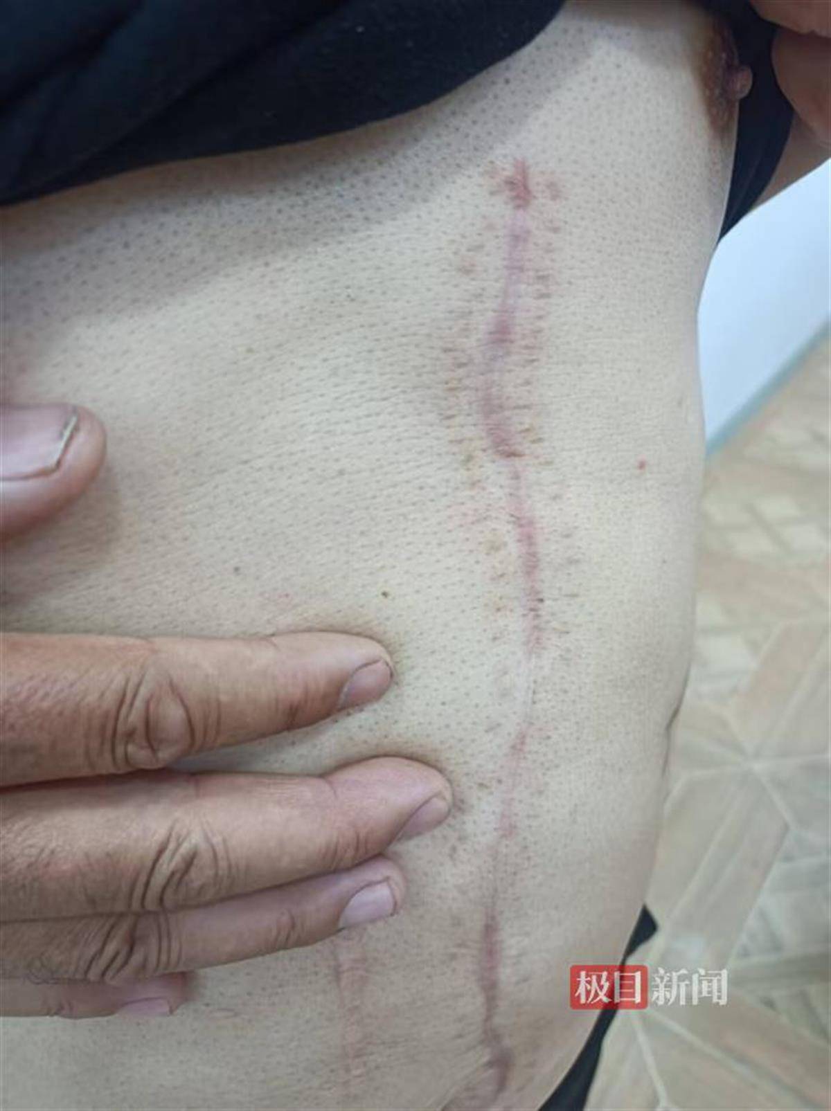 阿美尼亚超级联赛
_病房悲剧之谜：男子住院当晚捅伤同病房父子并跳楼身亡阿美尼亚超级联赛
，医院称其入院时无精神异常表现