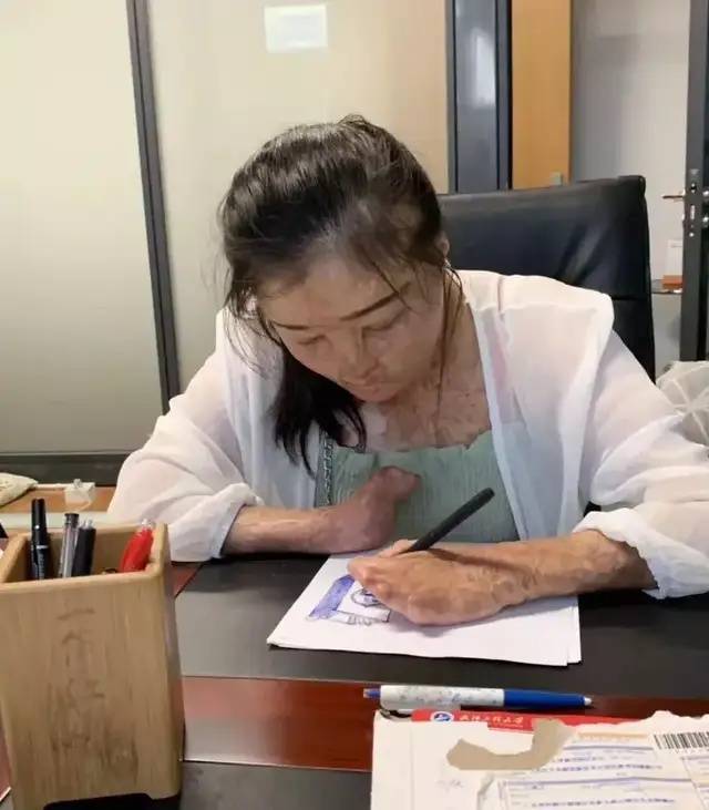 皇冠皇冠代理平台
_全身95%烧伤女孩订婚了皇冠皇冠代理平台
,与未婚夫同年同月同日生,本人发声:请大家祝福我们吧