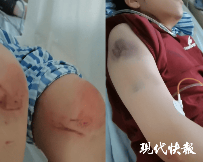 皇冠信用網APP下载
_石家庄被家暴女子驾车逃跑致丈夫身亡皇冠信用網APP下载
，一审以故意杀人罪获刑11年