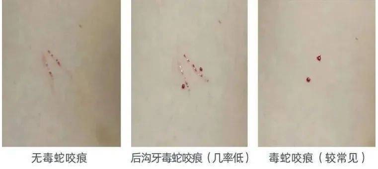 WNBA比分
_太吓人!深圳16天接警232宗!“抓不完WNBA比分
,根本抓不完……”