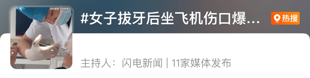 皇冠信用盘庄家
_高空惊魂皇冠信用盘庄家
！女子拔智齿后坐飞机嘴里突然开始冒鲜血……医生紧急提醒