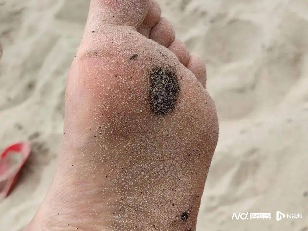 皇冠登3管理出租
_“擦都擦不掉”！多名网友反映深圳大梅沙现黑色油污皇冠登3管理出租
，味道刺鼻！官方回应