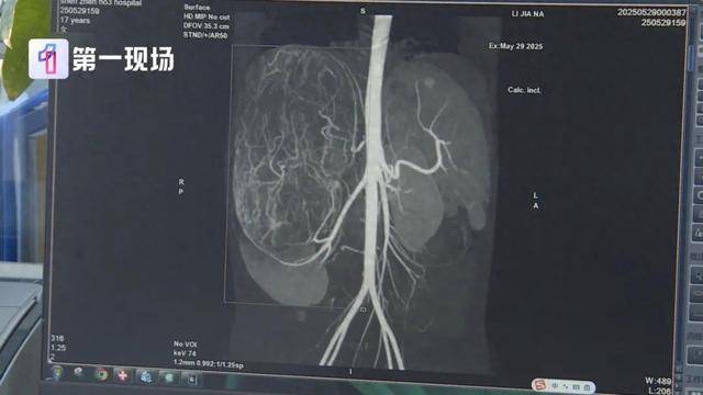 皇冠信用網在线申请
_17岁女孩确诊癌症皇冠信用網在线申请
！买衣服时店员看出端倪……这个细节很重要！
