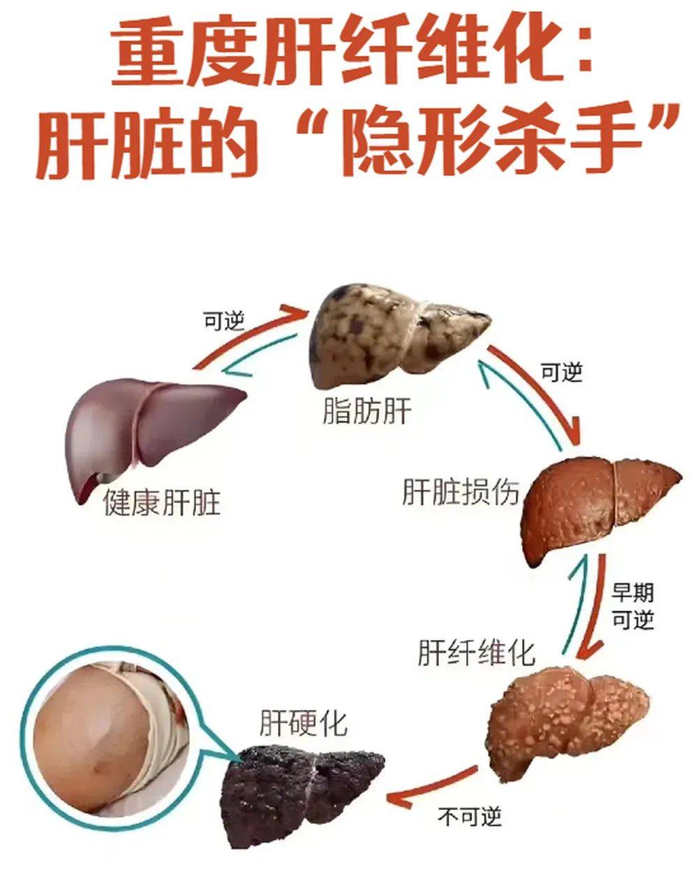 皇冠信用網登2代理
_山东网红“草帽姐”自曝患肝纤维化终生无法康复皇冠信用網登2代理
,劝粉丝不要经常生气,专家提醒