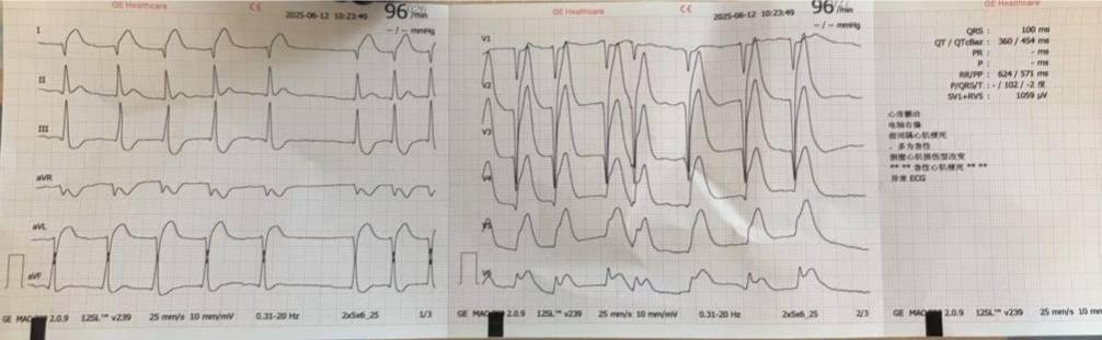 足球平台代理怎么做
_一次亲热足球平台代理怎么做
！杭州男子差点没命！这种凶险急症梅雨天高发