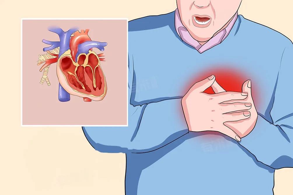 足球平台代理怎么做
_一次亲热足球平台代理怎么做
！杭州男子差点没命！这种凶险急症梅雨天高发