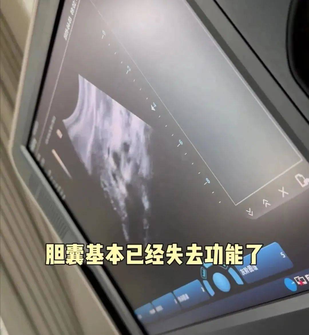 香港籃球投注
_36岁知名女演员确诊香港籃球投注
！“已基本失去功能”