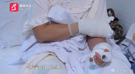 皇冠信用网注册
_女子水中捡漂亮石头装裤兜里被烧伤皇冠信用网注册
,医生:“石头”初步判定是磷