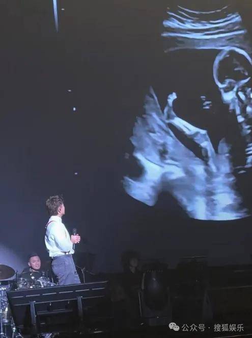 皇冠信用網会员开户
_调侃“接受不了生女儿”被骂好几天皇冠信用網会员开户
，他自曝差点因此家庭破裂......