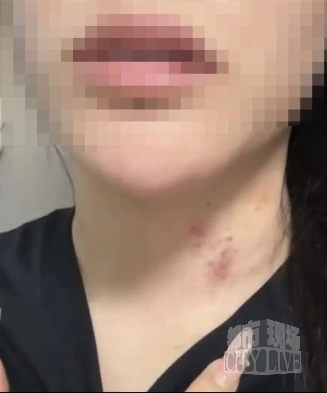 皇冠信用網最高占成
_湖南衡阳29岁女子疑被男友施暴后从25楼跳下身亡 男友徐某此前还刺激说：“你放心皇冠信用網最高占成
，她不会去死的”