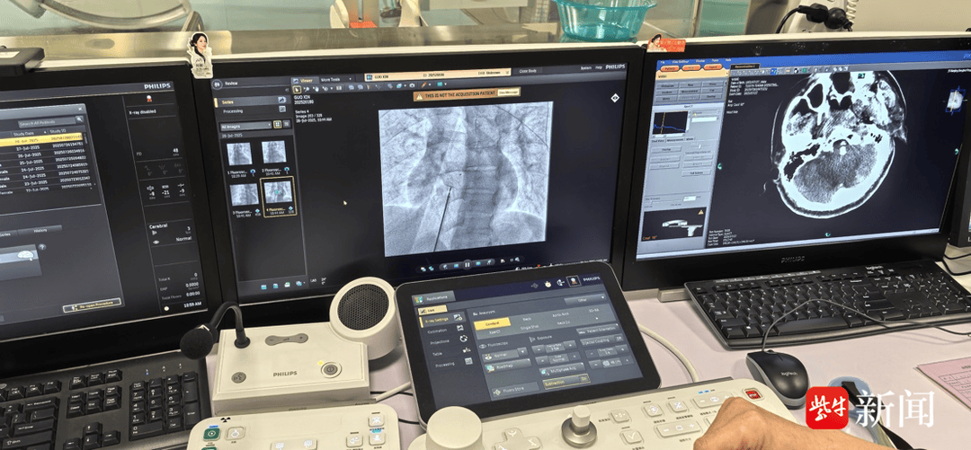 买球的正规网站
_36岁青年男性突发脑梗死买球的正规网站
，病因竟是心脏上有个“洞”！