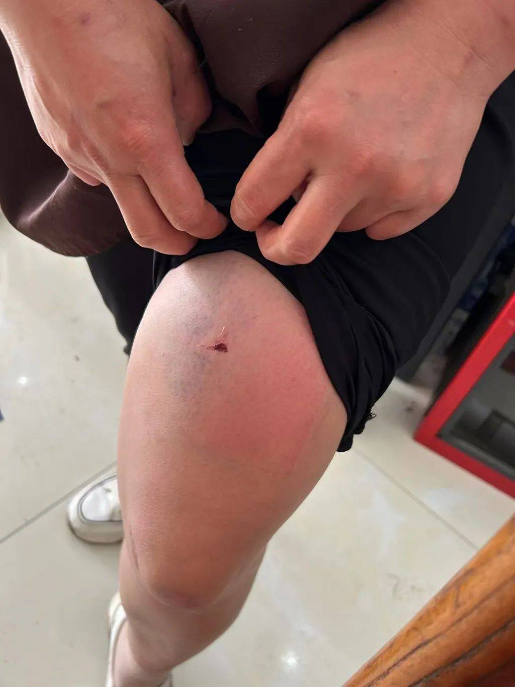 皇冠信用网会员_云南一男子酒后逼问妻子“是否出轨”并施暴皇冠信用网会员，被警方行拘4日